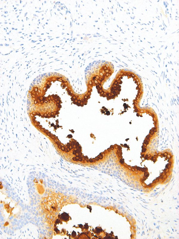 PSA-IHC654-Prostate