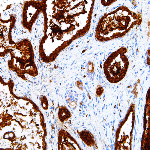 PSAP-IHC655-Prostate