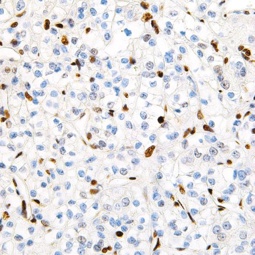 TFE3-IHC672-Kidney