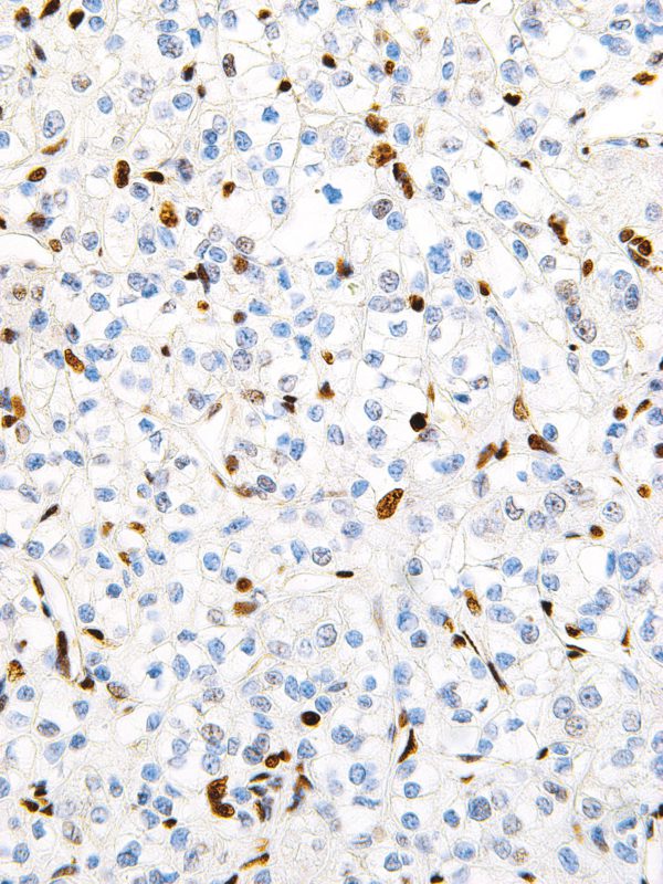 TFE3-IHC672-Kidney