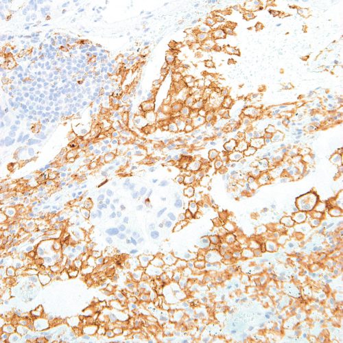 TIM3-IHC003-Lung