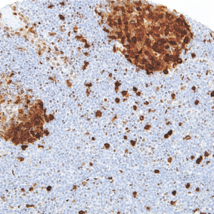Thymidylate-Synthase-IHC697-Tonsil