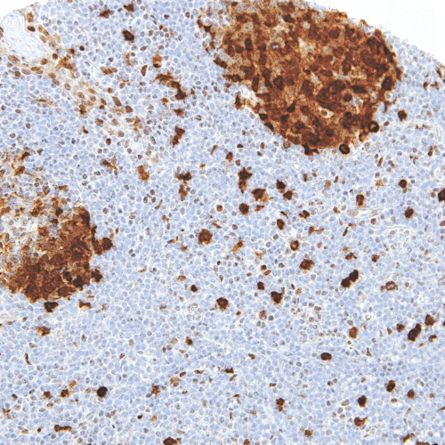 Thymidylate-Synthase-IHC697-Tonsil