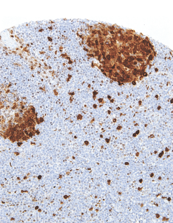 Thymidylate-Synthase-IHC697-Tonsil