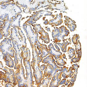 Thyroglobulin-IHC674-Thyroid