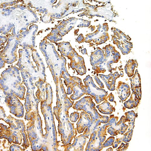 Thyroglobulin-IHC674-Thyroid