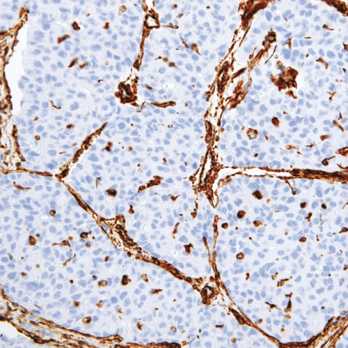 Vimentin-IHC684-Liver