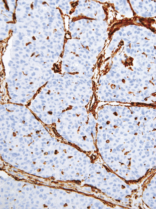 Vimentin-IHC684-Liver