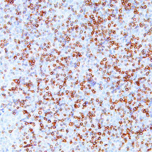 hENT1-IHC595-Thymus