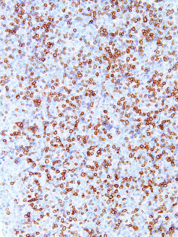 hENT1-IHC595-Thymus