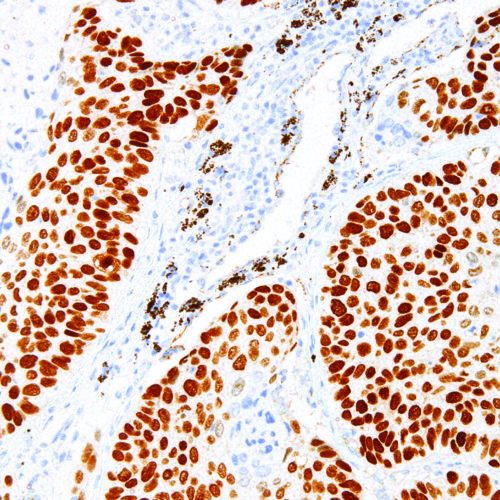 p40-IHC040-Lung