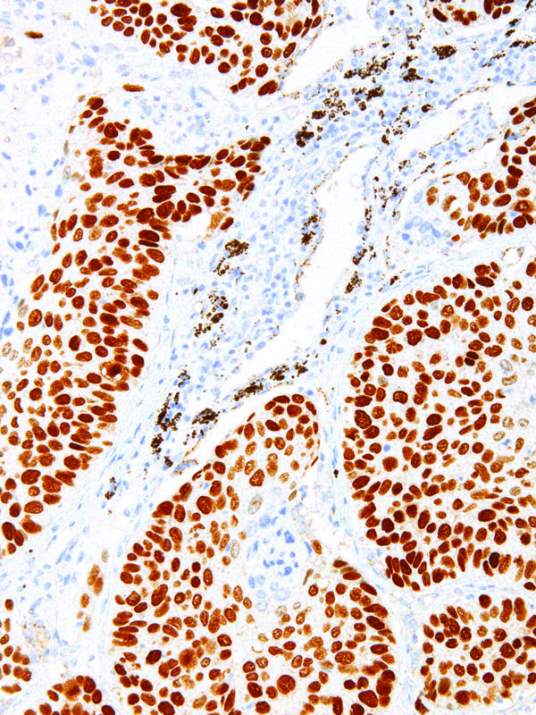 p40-IHC040-Lung