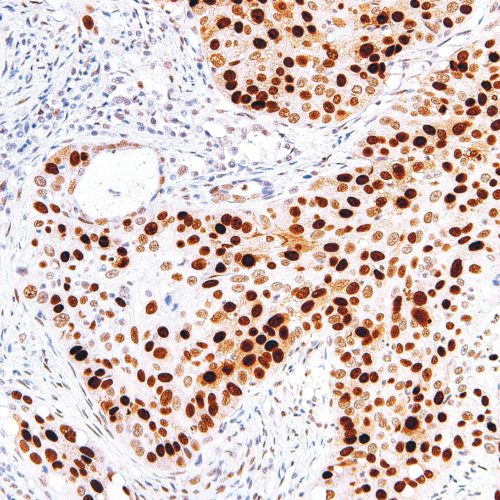 p53-IHC053-Lung