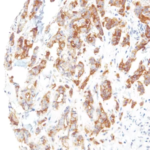 B7H4-IHC104-Breast (Mouse)