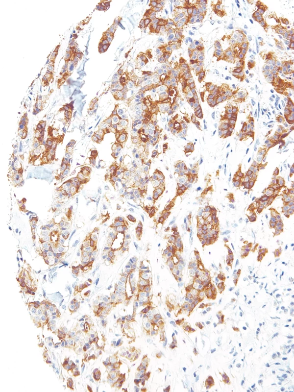 B7H4-IHC104-Breast (Mouse)