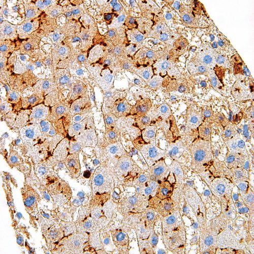 CD13-IHC013-Liver