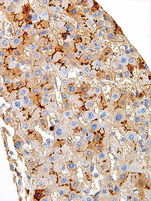 CD13-IHC013-Liver