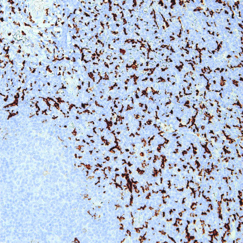 CD163-IHC163-Tonsil