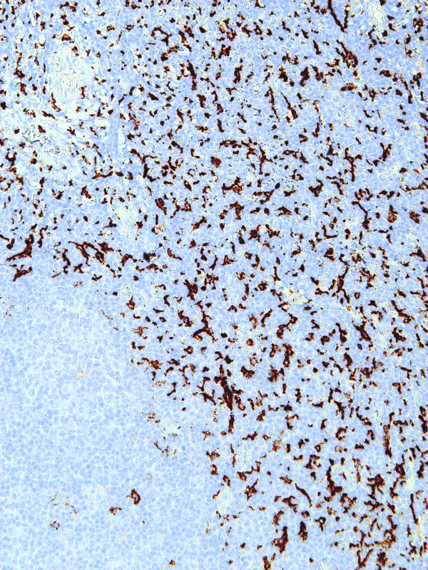 CD163-IHC163-Tonsil