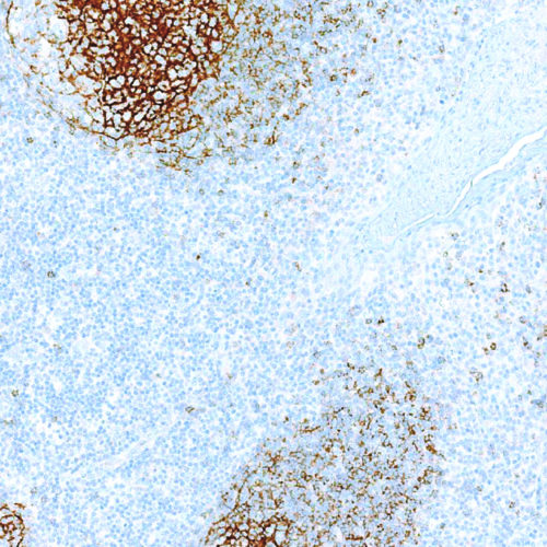 CD23-IHC023-Tonsil (Rabbit)