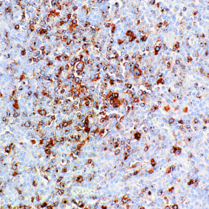 CD30-IHC130-Hodgkin Lymphoma (Mouse)