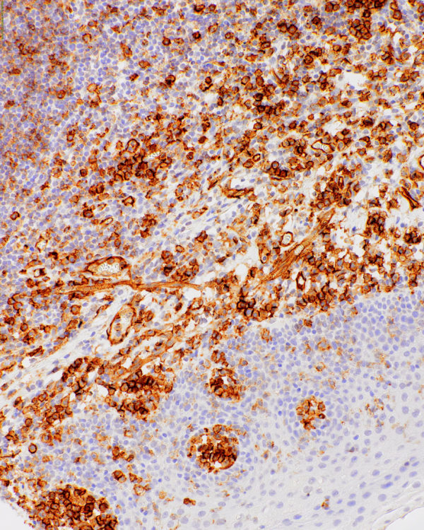 CD31-IHC031-tonsil