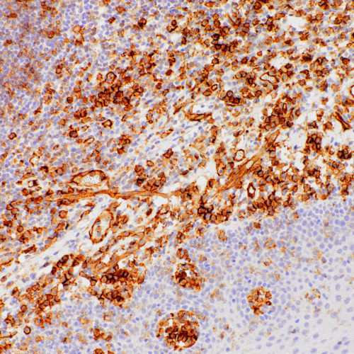 CD31-IHC031-tonsil