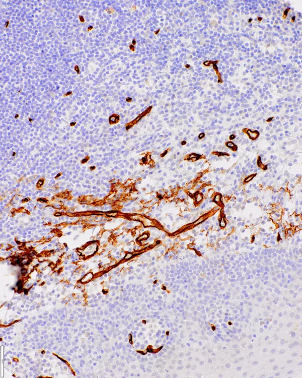 CD34-IHC034-Tonsil