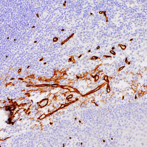 CD34-IHC034-Tonsil