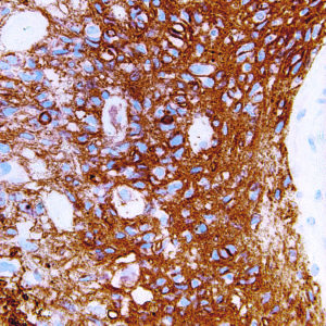 CD56-IHC056-Brain