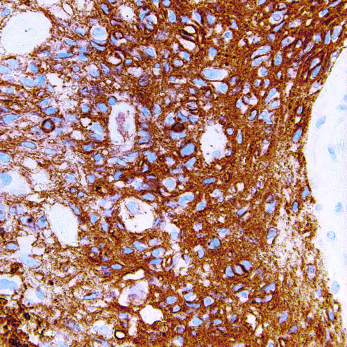 CD56-IHC056-Brain