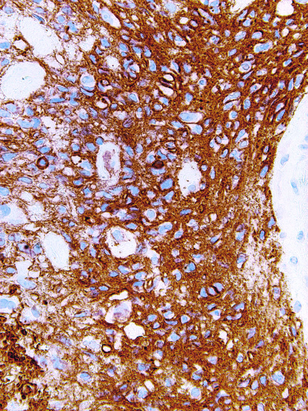 CD56-IHC056-Brain