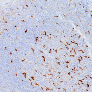 CD68-IHC068-Tonsil