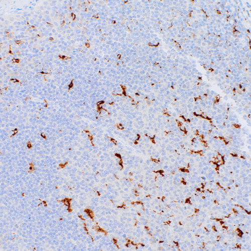 CD68-IHC068-Tonsil