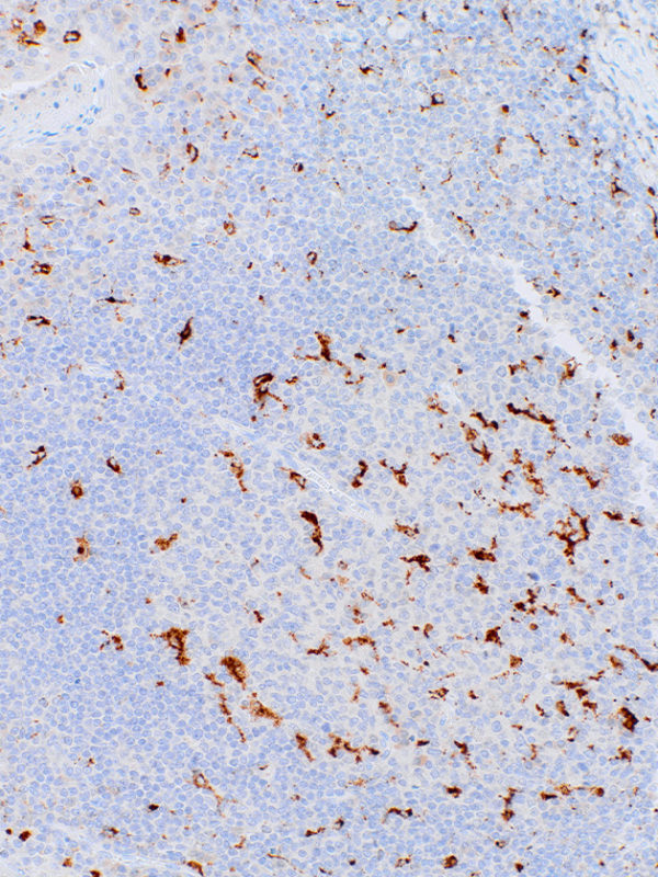 CD68-IHC068-Tonsil