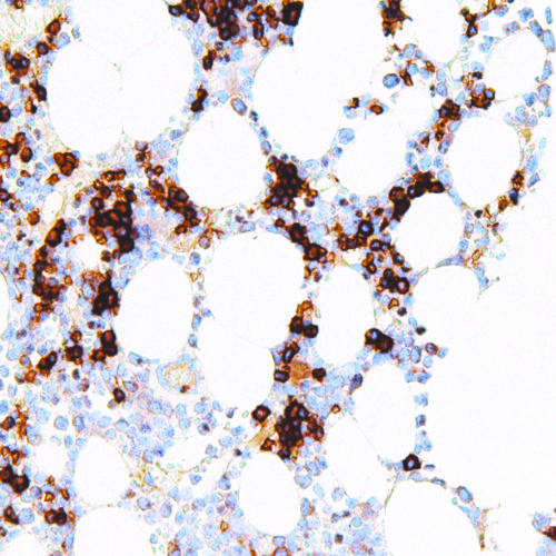 CD71-IHC071-Bone-Marrow