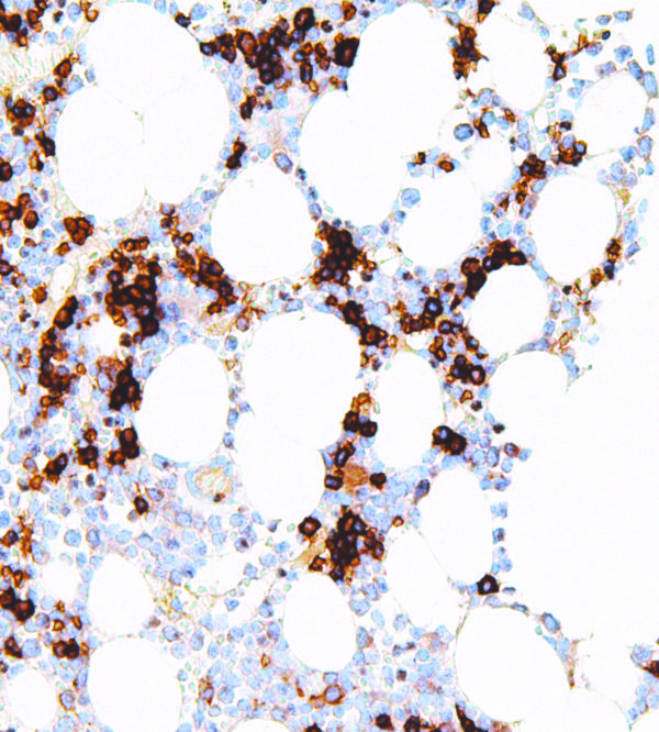 CD71-IHC071-Bone-Marrow