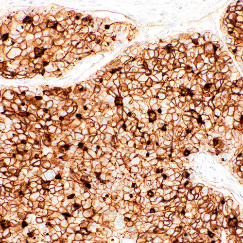 CD73-IHC073-Liver