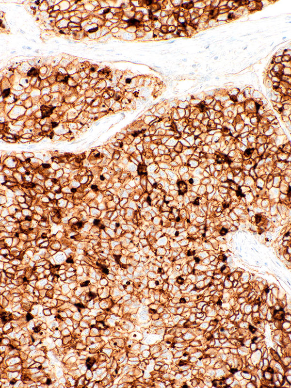 CD73-IHC073-Liver