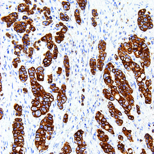 CD99-IHC099-Esophagus