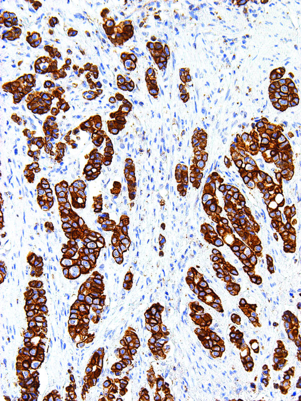 CD99-IHC099-Esophagus