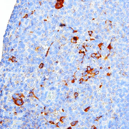 CTLA-4-IHC004-Tonsil