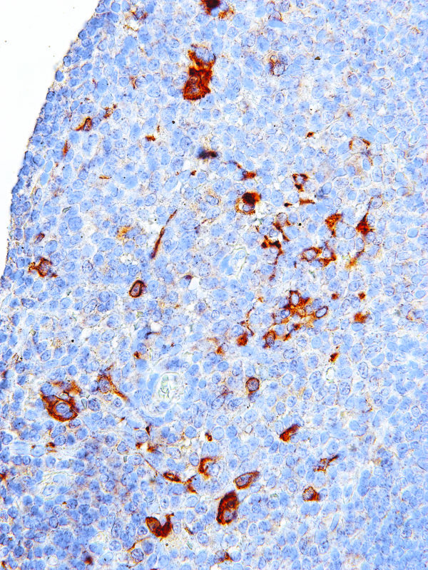 CTLA-4-IHC004-Tonsil