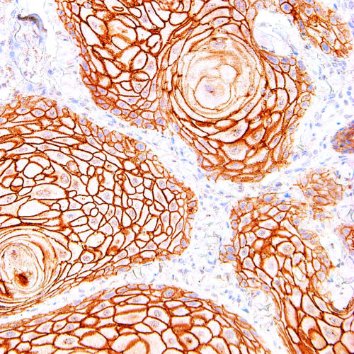 Desmoglein-3-IHC083-Skin