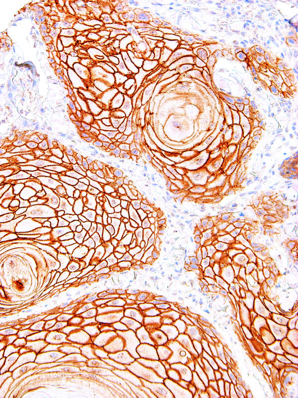 Desmoglein-3-IHC083-Skin