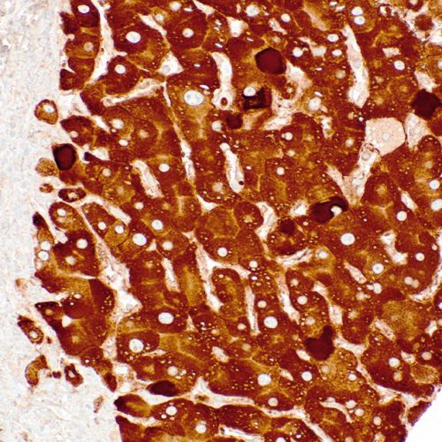 HBsAg-IHC178-Liver