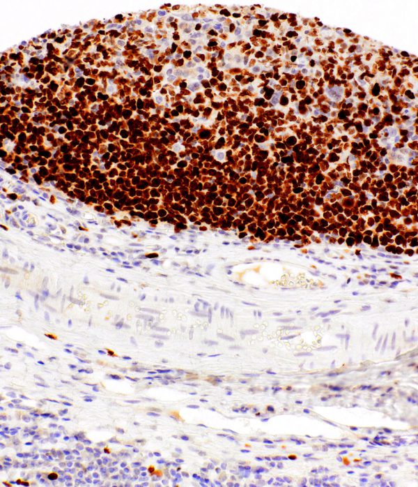 Ki67-IHC167-Tonsil