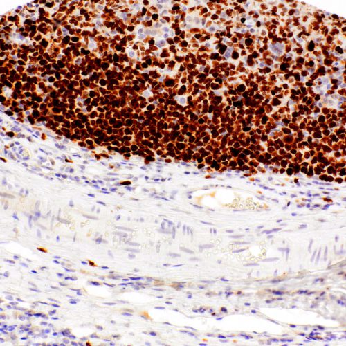 Ki67-IHC167-Tonsil