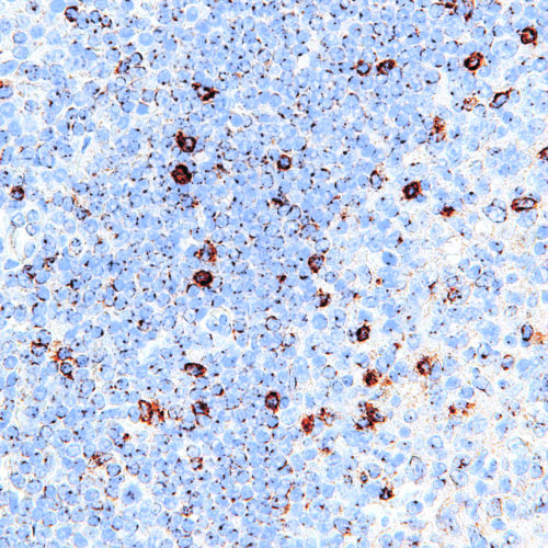 LAG3-IHC103-Tonsil (Mouse)