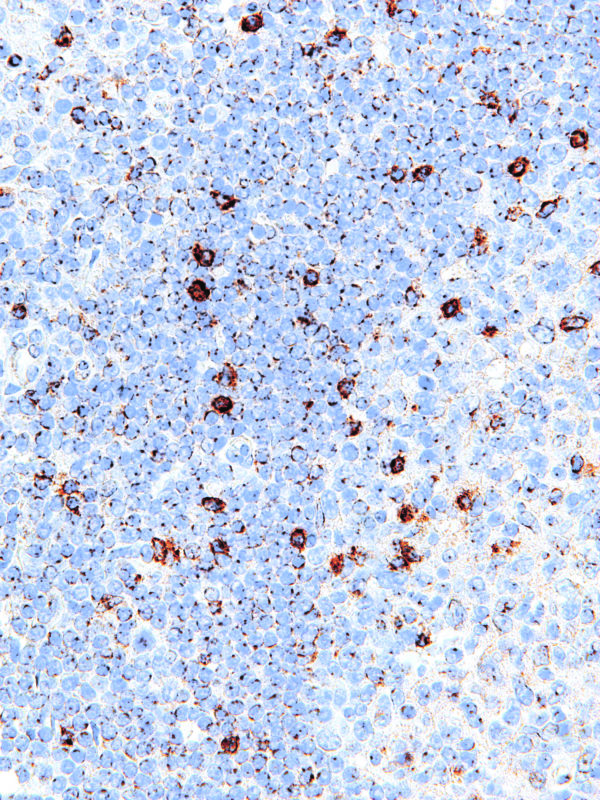 LAG3-IHC103-Tonsil (Mouse)